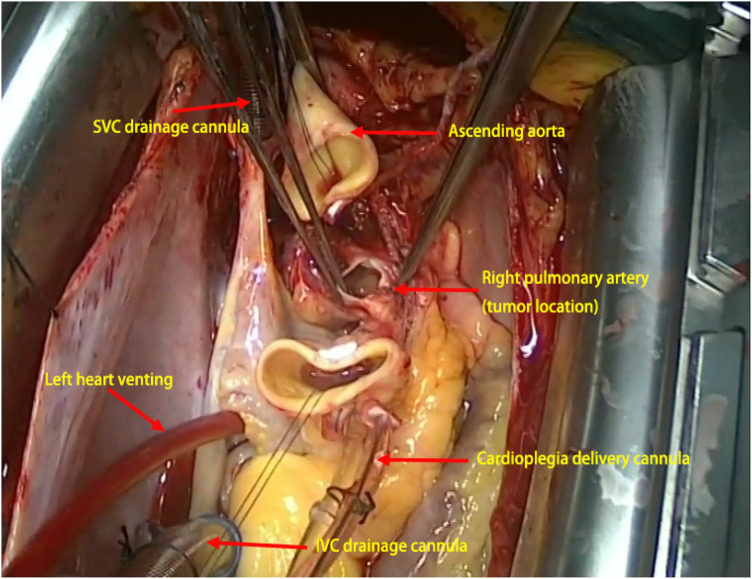 Figure 2