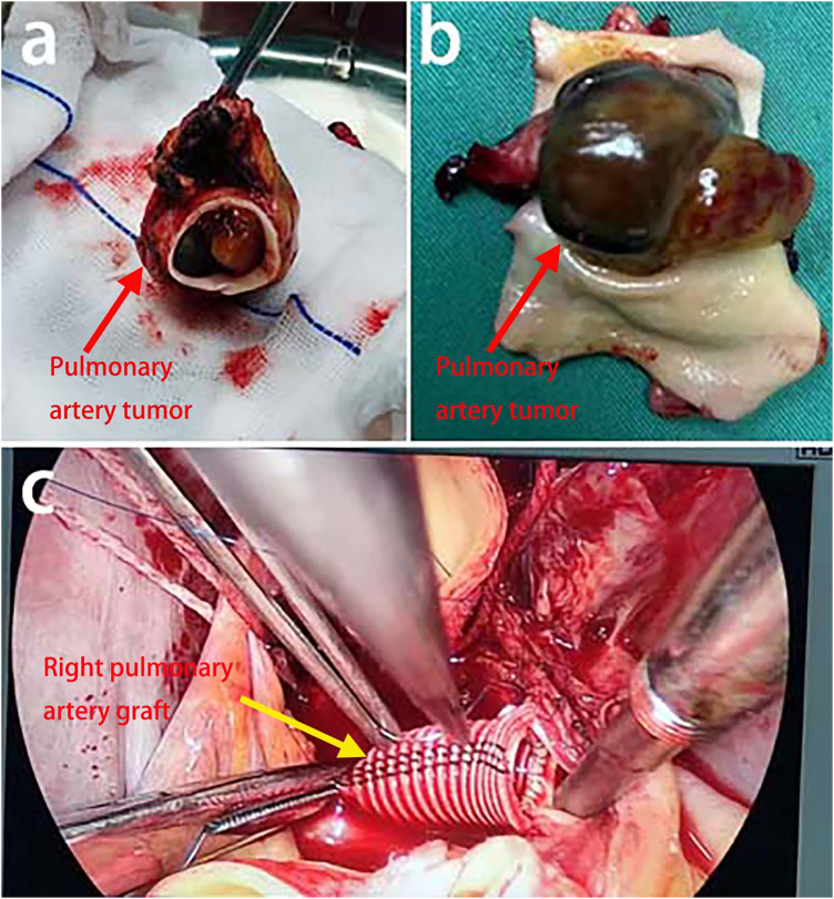 Figure 3