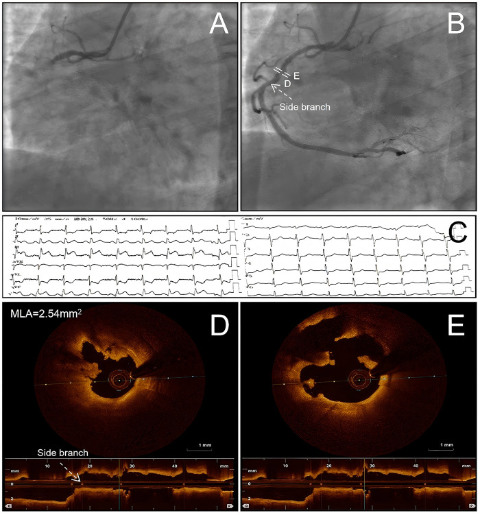 Figure 1