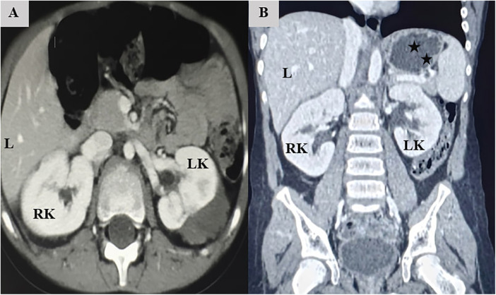 Figure 2