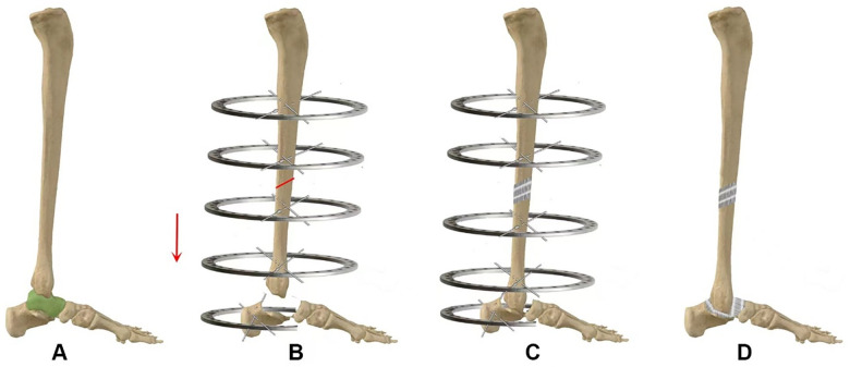 Figure 1