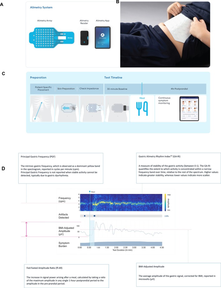 FIGURE 1