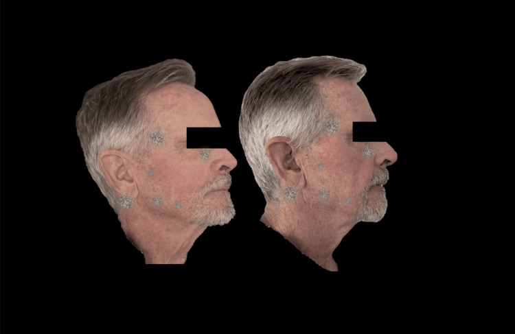 Figure 11