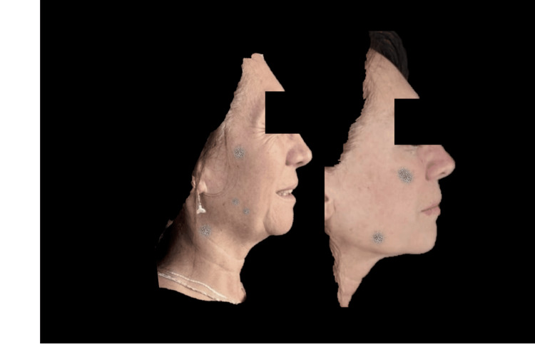 Figure 13