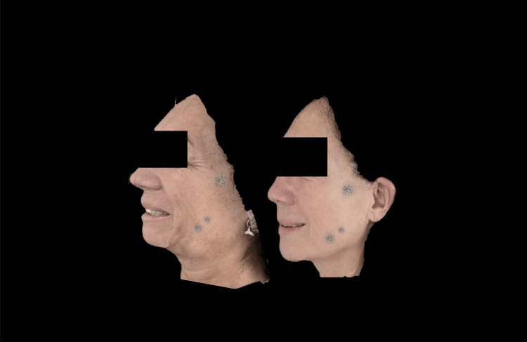 Figure 14