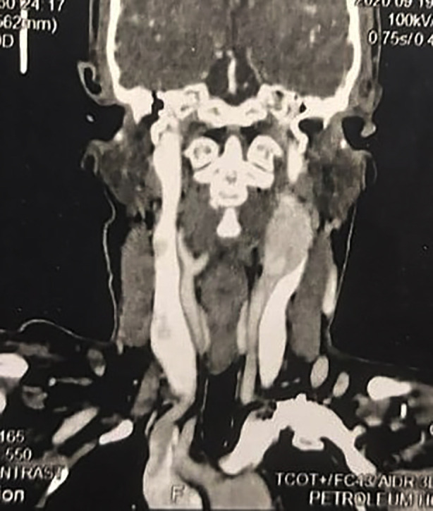 Fig.1