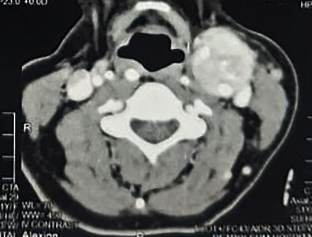 Fig.2