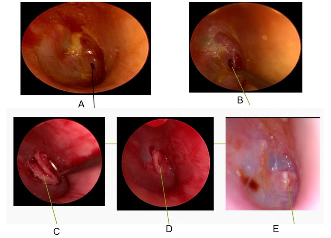 Fig.1