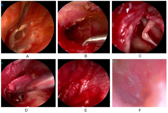 Fig.2