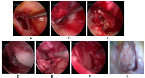 Fig.3