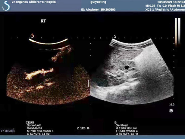 Fig.1
