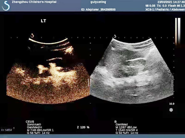 Fig.2