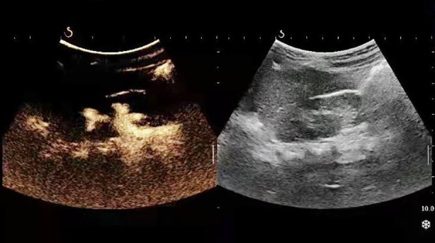 Fig.3