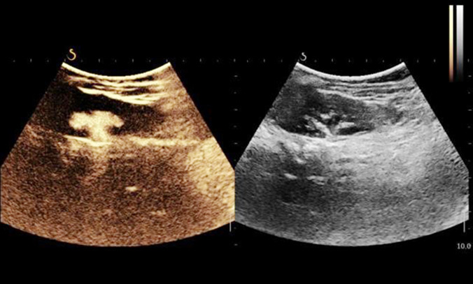 Fig.4