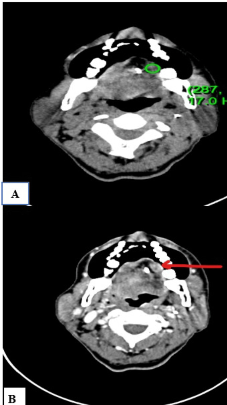 Figure 9