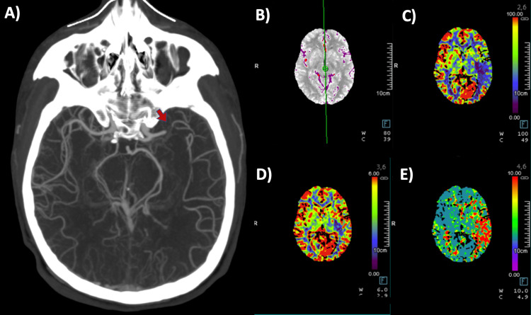 Figure 1