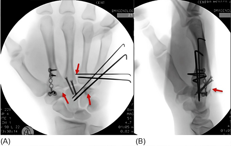 Figure 4