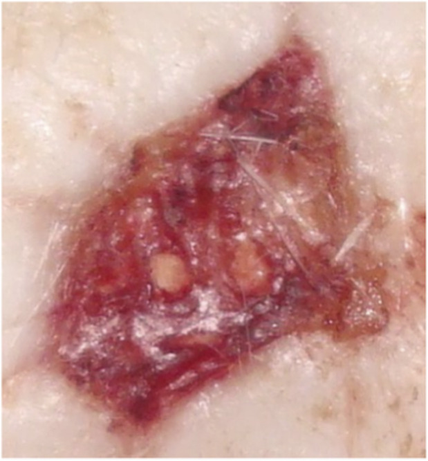 Figure 10
