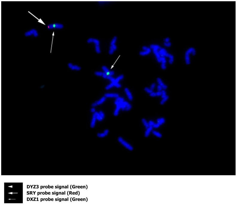 Figure 4