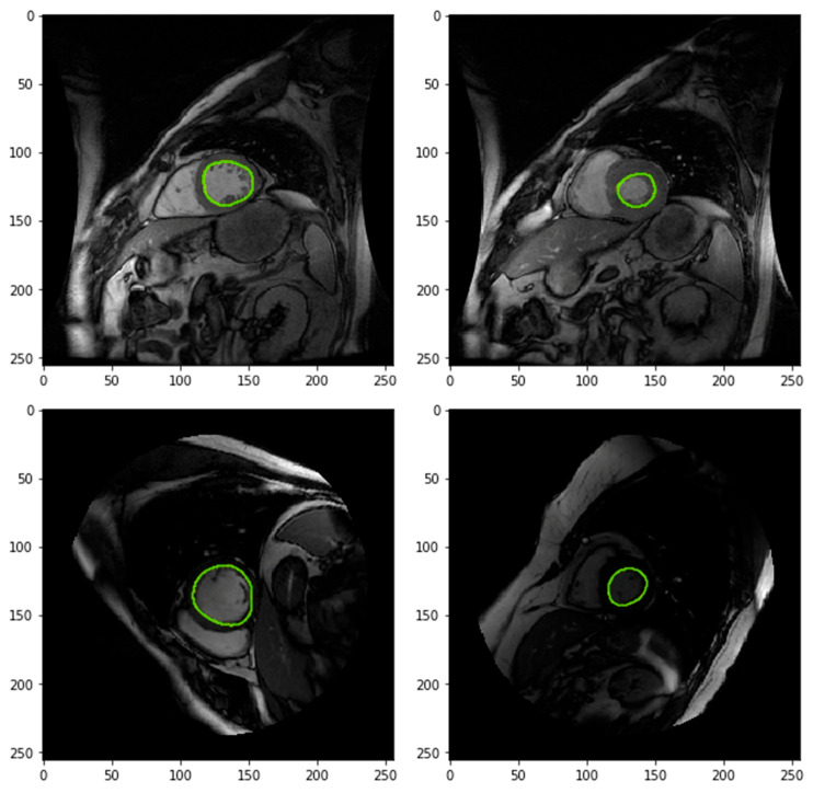 Figure 2