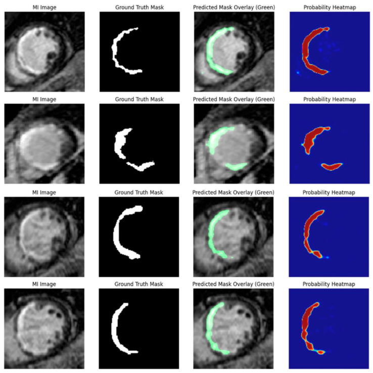 Figure 13
