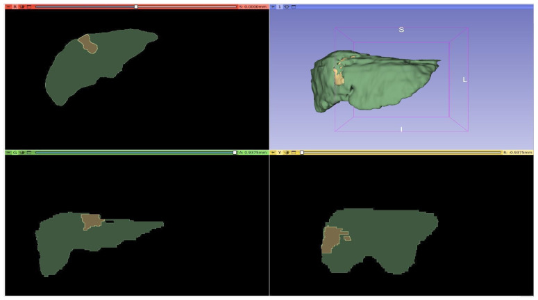 Figure 3