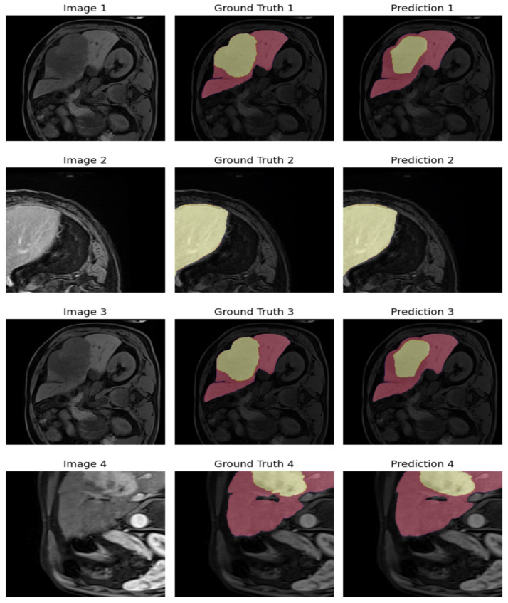 Figure 11