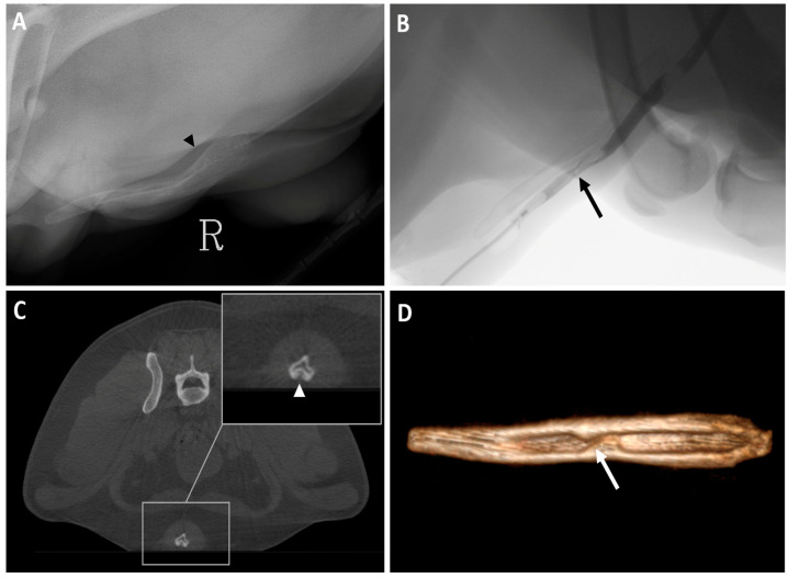 Figure 14