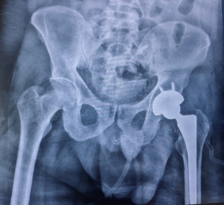 Figure 6