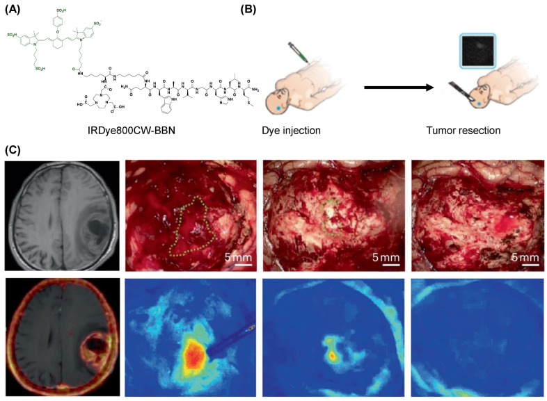 Figure 17