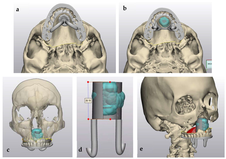 Figure 6