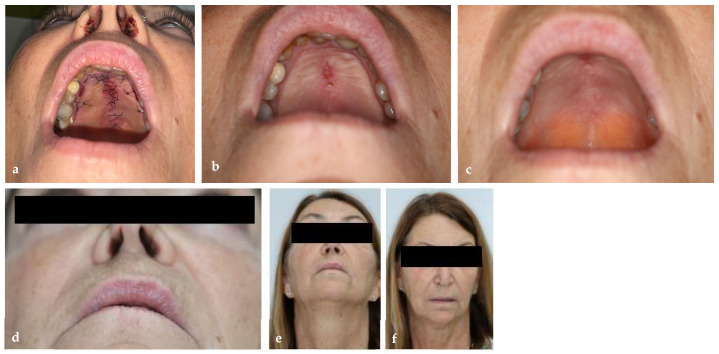 Figure 12