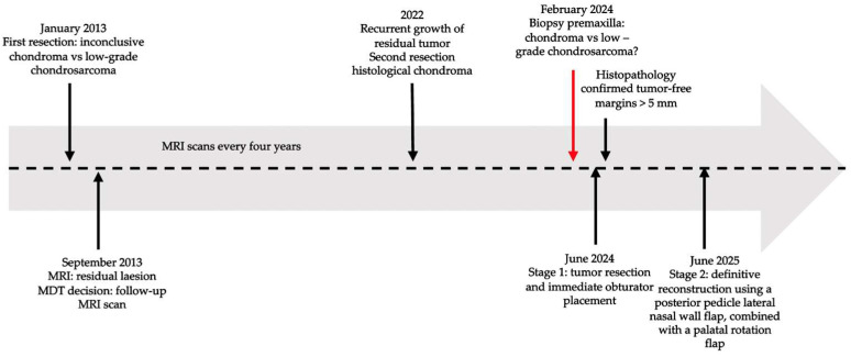 Figure 13