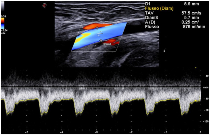 Figure 6