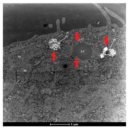 Figure 22