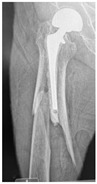 Figure 18