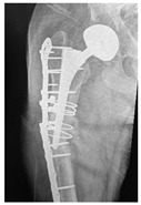 Figure 20