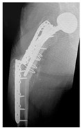 Figure 21