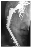 Figure 22