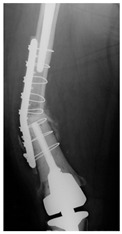 Figure 23