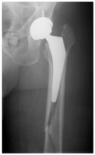 Figure 25