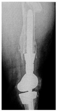 Figure 28