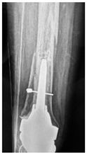 Figure 29