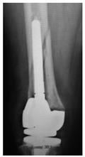 Figure 31