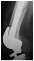 Figure 32