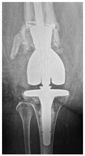 Figure 33