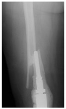 Figure 35