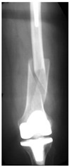 Figure 36