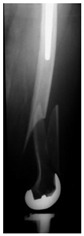 Figure 37