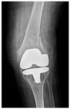 Figure 38